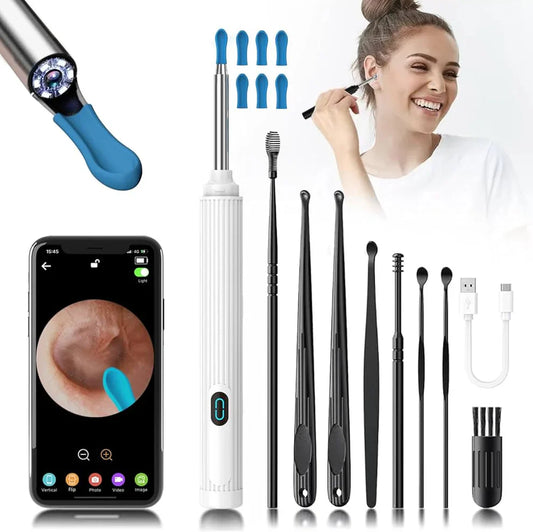Otoscopio Pro™ - Limpiador de Oídos con Cámara HD - ¡Limpieza Rápida y Efectiva! 👂🏻