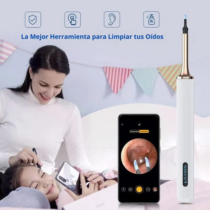Otoscopio Pro™ - Limpiador de Oídos con Cámara HD - ¡Limpieza Rápida y Efectiva! 👂🏻