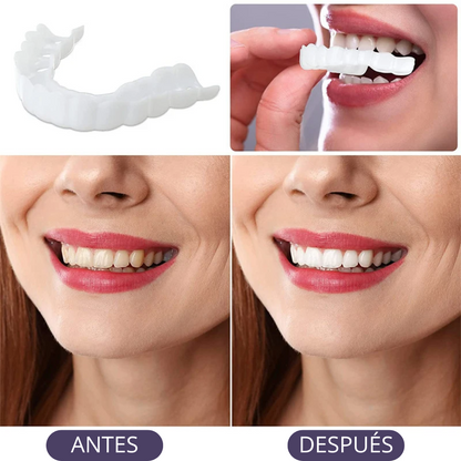 Carillas Dentales Adaptables - Transforma tu Sonrisa 😱OFERTA EXCLUSIVA 2X1😱