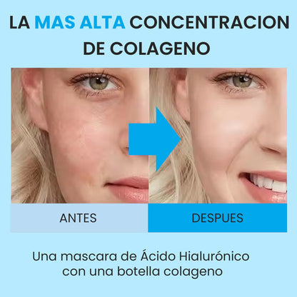 Mascarillas con Colágeno + Ácido Hialurónico - 😍La Revolución de la Belleza😍50% DE DESCUENTO😱